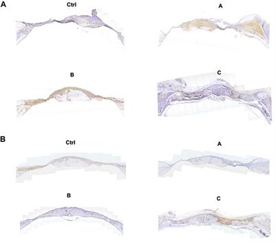 Enhanced bone regeneration via local low-dose delivery of PTH1-34 in a composite hydrogel